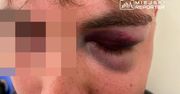 Brutalne pobicie na Bulwarach Wiślanych pod Centrum Nauki Kopernik. 27-latek doznał poważnych obrażeń. Sprawcy poszukiwani