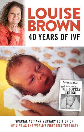 Louise Joy Brown - pierwsze dziecko z probówki. Kończy 40 lat