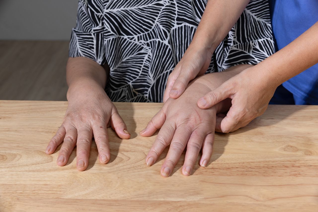 Diet adjustments to combat oedema: More than just cutting salt