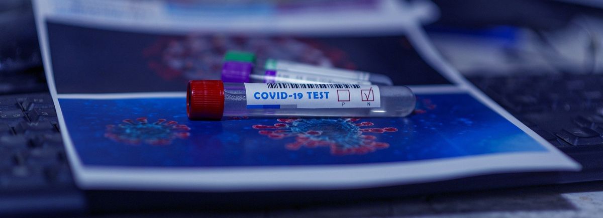Koronawirus. Słowacja masowo testuje obywateli
