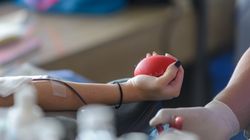 Upuszczanie krwi - na czym polega i jakie są wskazania?