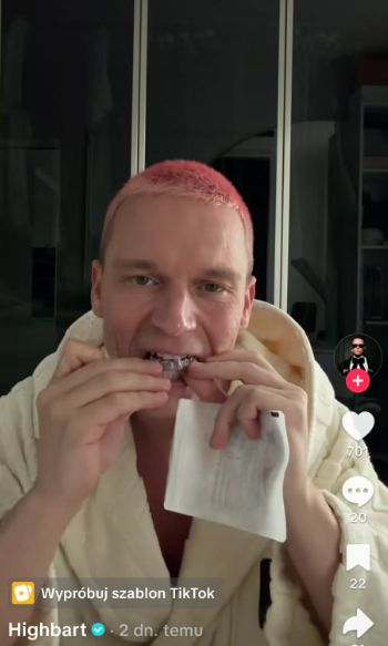 Bart Pniewski i jego nakładki na zęby