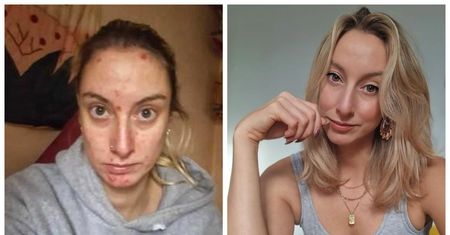 Wypijała dwie butelki wódki dziennie. Przeszła niebywałą przemianę
