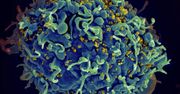 Jak wywabić wirusa HIV z komórek? Naukowcy znaleźli sposób