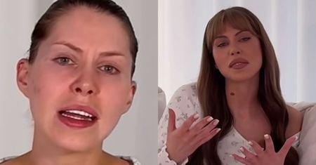 Julia von Stein oznajmia, że przez lifting twarzy NIE MOŻE się uśmiechać. "Spie*dolicie sobie życie" (FOTO)