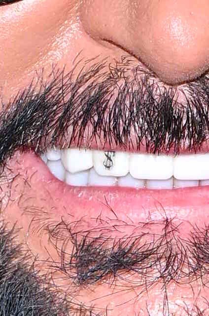 Krzysztof Rutkowski z dolarem na zębie