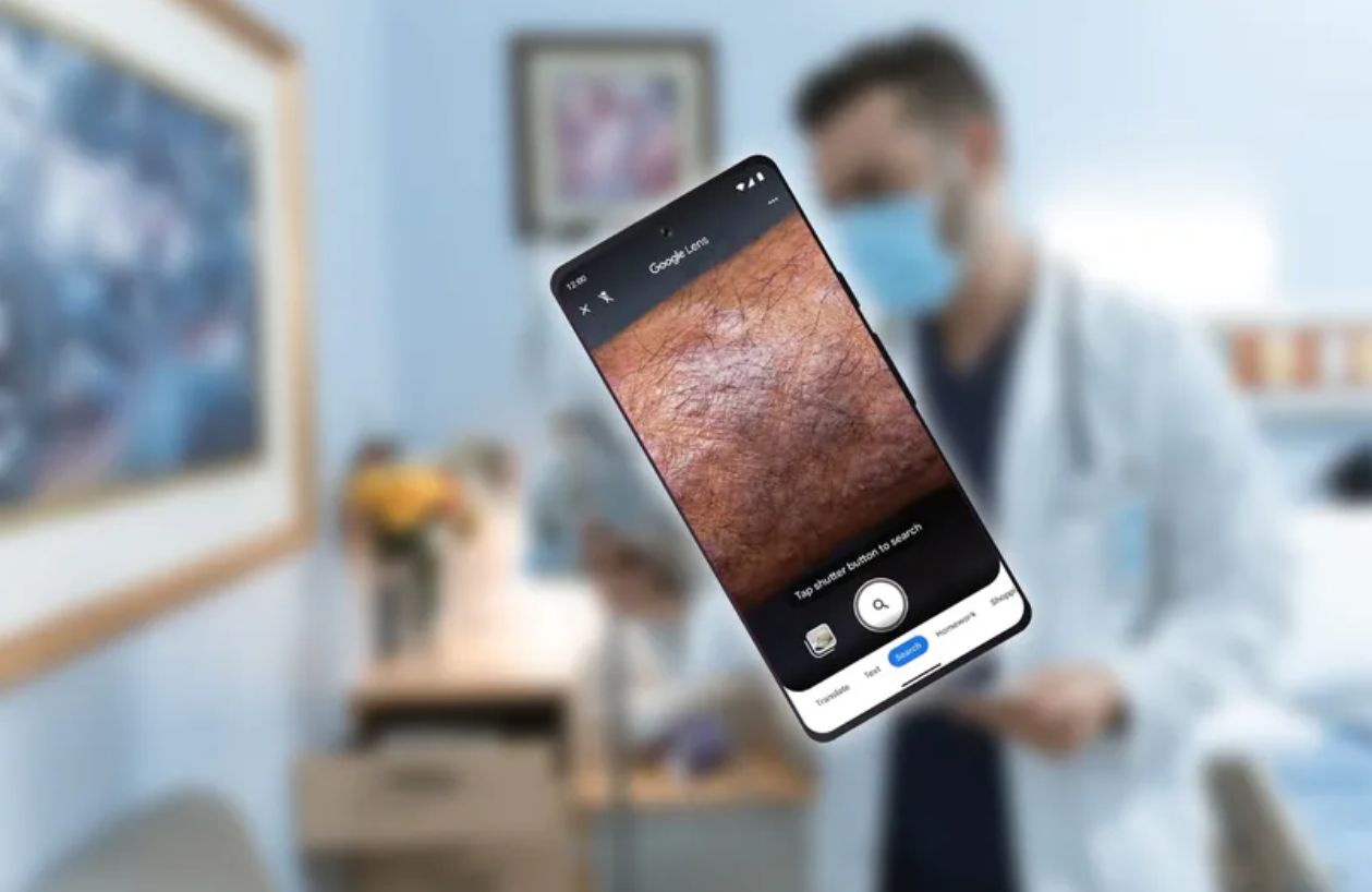 Obiektyw Google pomoże w walce z problemami skórnymi