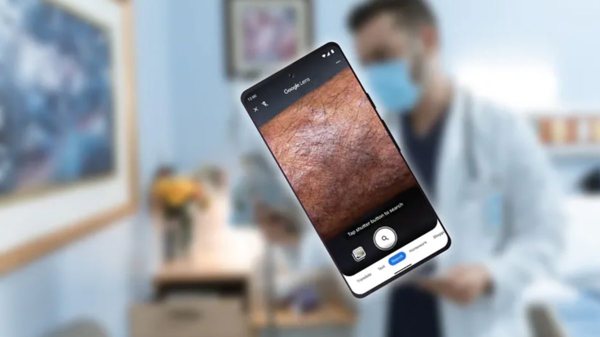 Obiektyw Google pomoże w walce z problemami skórnymi