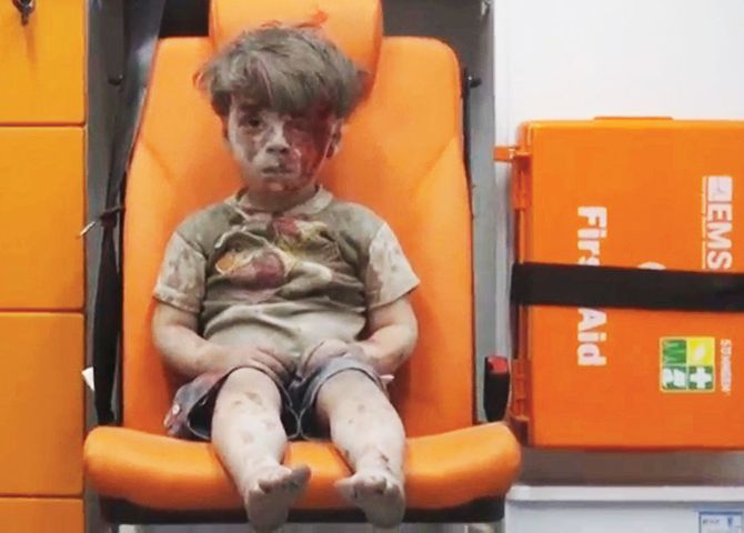 Chłopiec stał się symbolem oblężonego Aleppo. Zobacz, jak wygląda 