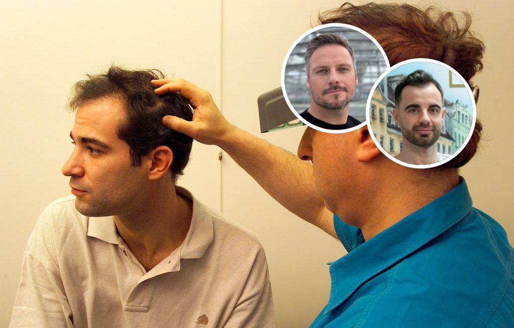 Komórki macierzyste, terapie genowe i laseroterapia. Nowe technologie w walce z łysieniem