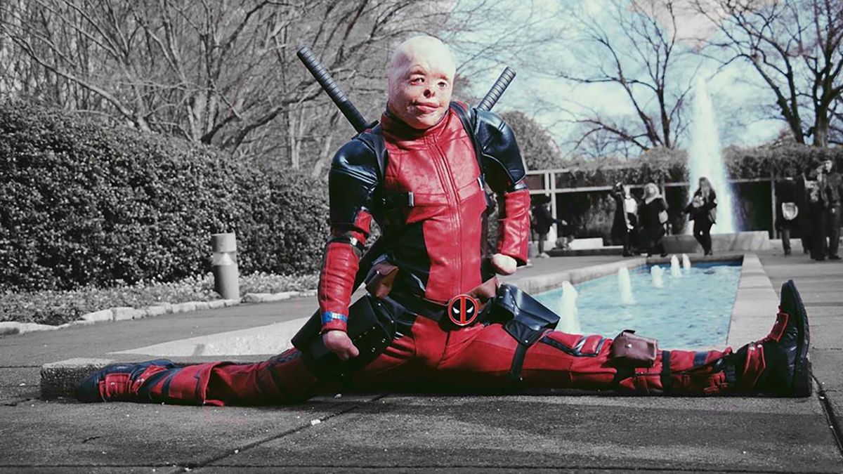 Zdjęcia ofiary poparzeń w cosplayu Deadpoola zwróciły uwagę Ryana Reynoldsa 1