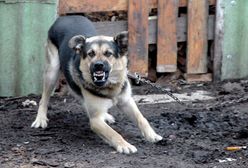Mazowieckie. W Mławie pies pogryzł trzyletnią dziewczynkę