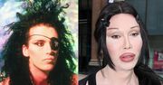 Nie żyje Pete Burns z Dead or Alive! Miał 57 lat...