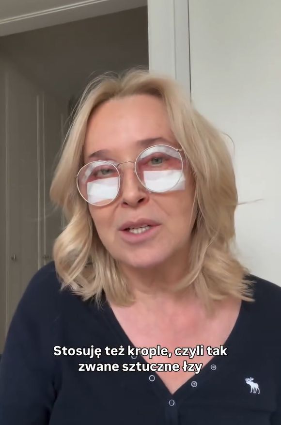 Agata Młynarska zrobiła operację powiek