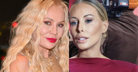 TYLKO U NAS! Monika Jarosińska oceniła obecny wygląd Małgorzaty Rozenek. "Medycyna estetyczna to nie TABU" [WIDEO]
