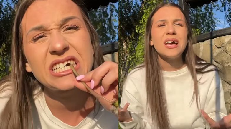 Tiktokerka straciła zęby