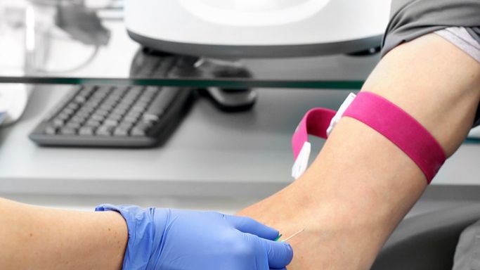 Pancytopenia to obniżenie erytrocytów, leukocytów i trombocytów we krwi