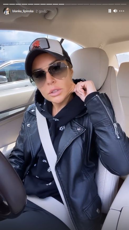 Blanka Lipińska pokazuje luźną skórę pod policzkami