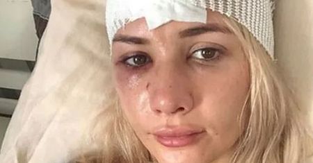 Beata Grucela z "Love Island" ma obrażenia głowy. Trafiła do szpitala