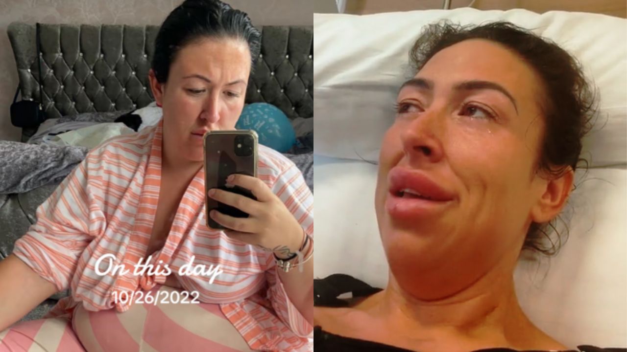 Woman regrets self-funded "Turkish makeover". Her appearance has drastically changed
