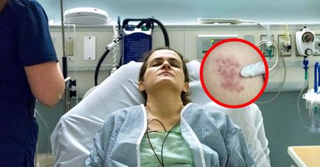 Objawem jest wysypka. "Choroba dotyka głównie ludzi po 50. roku życia"