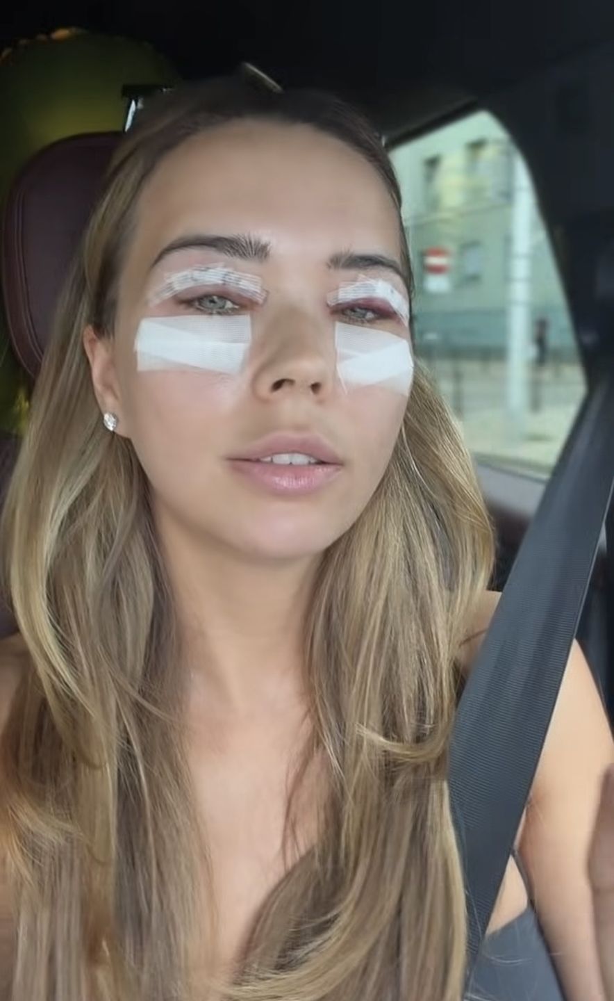 Sandra Kubicka po operacji