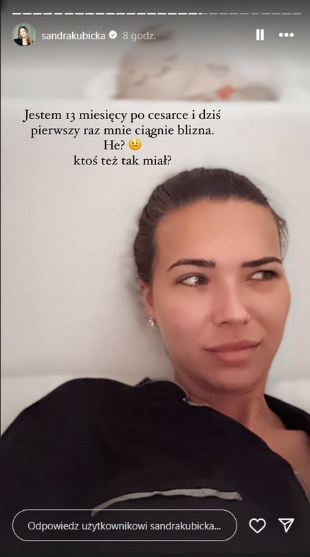 Sandra Kubicka narzeka na bliznę po cesarce