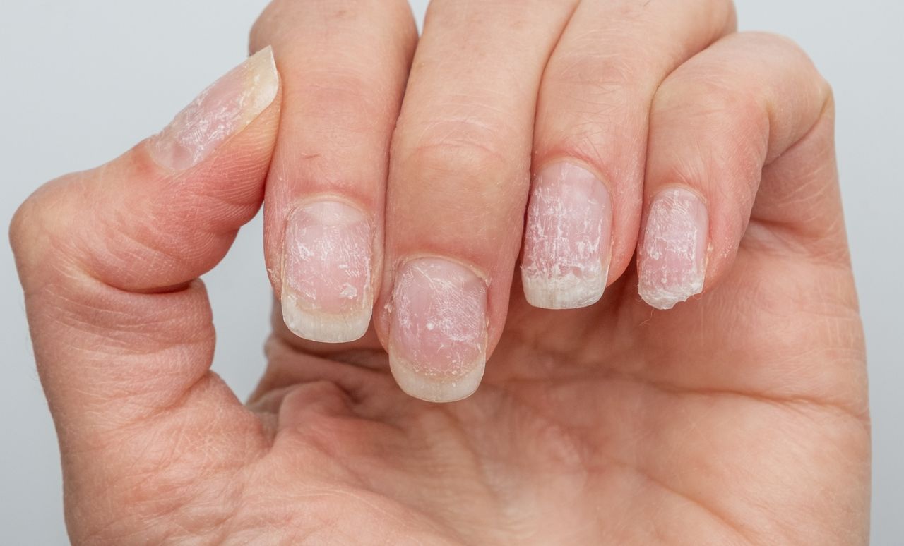 Jak odżywić paznokcie zniszczone po hybrydzie?