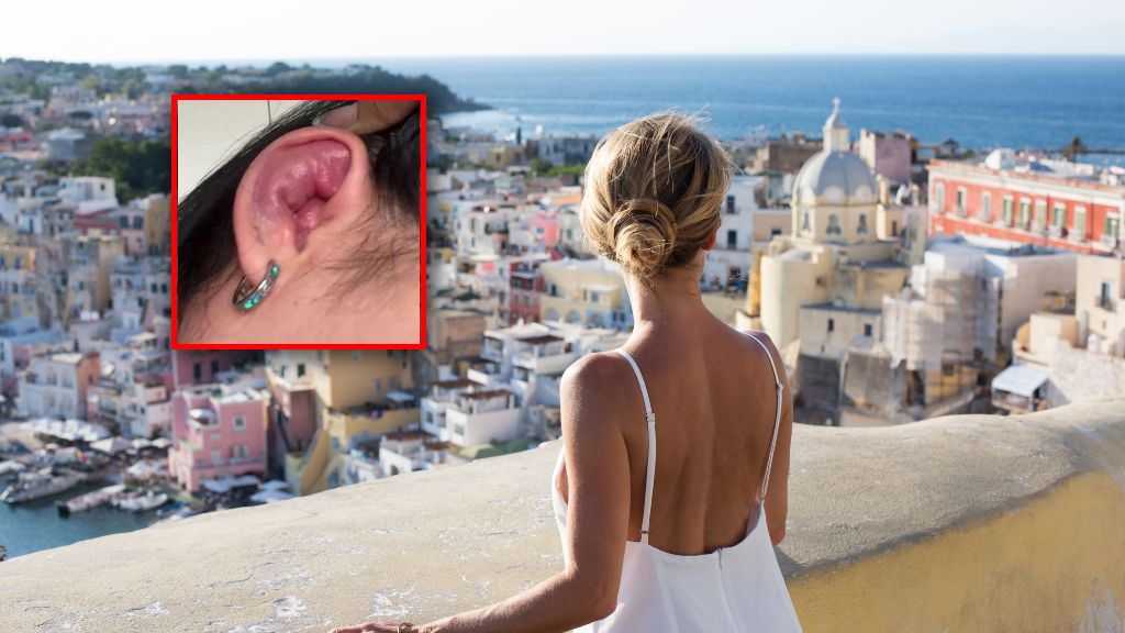 Ucho Halle znacząco spuchło