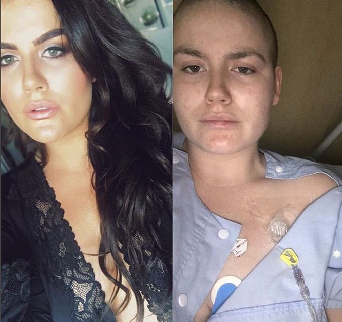 Bianca choruje na raka piersi