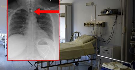 Zdziwienie na SOR-rze. "Jak to możliwe?". Oto co znaleźli w jej ciele