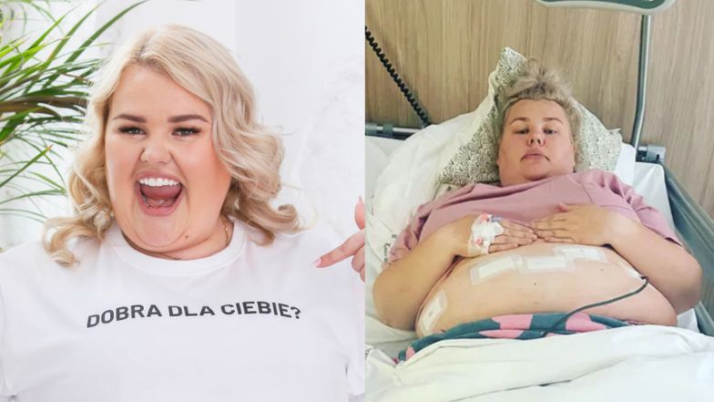 Kinga Zawodnik o ciemnych stronach operacji zmniejszania żołądka