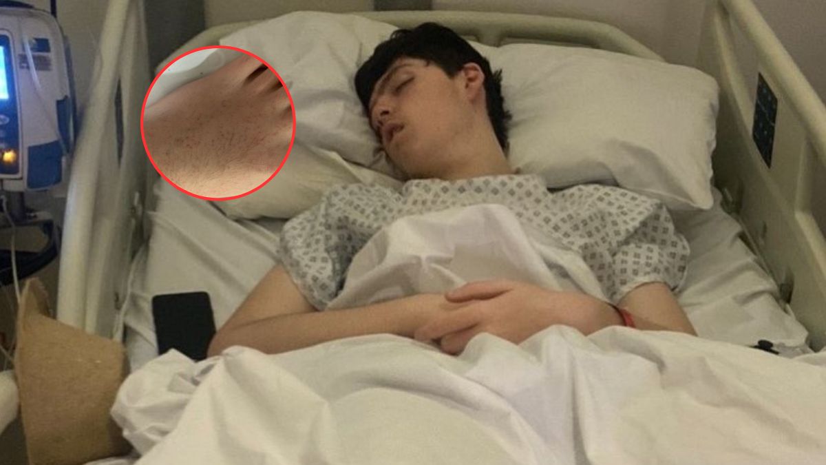 Ból był tak silny, że nie pomagały żadne leki