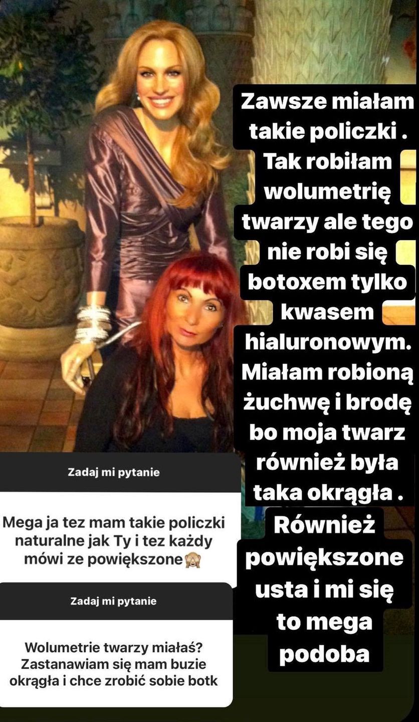 Adrianna Eisenbach z "Królowych życia" o operacjach plastycznych