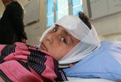 Świat piętnuje Saudyjczyków za mord na dziennikarzu. Jemen umiera w ciszy