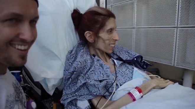 Rachael Farrokh - chora na anoreksję aktorka - stawia pierwsze od miesięcy kroki