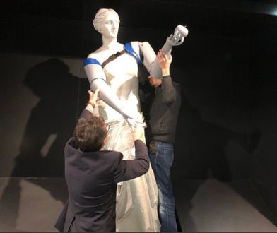 Wenus z Milo dostała... protezy rąk! Zaskakująca akcja organizacji wspierającej niepełnosprawnych