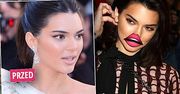 Kendall Jenner uległa modzie i powiększyła sobie usta! Próbuje upodobnić się do reszty sióstr? Różnicę widać gołym okiem!