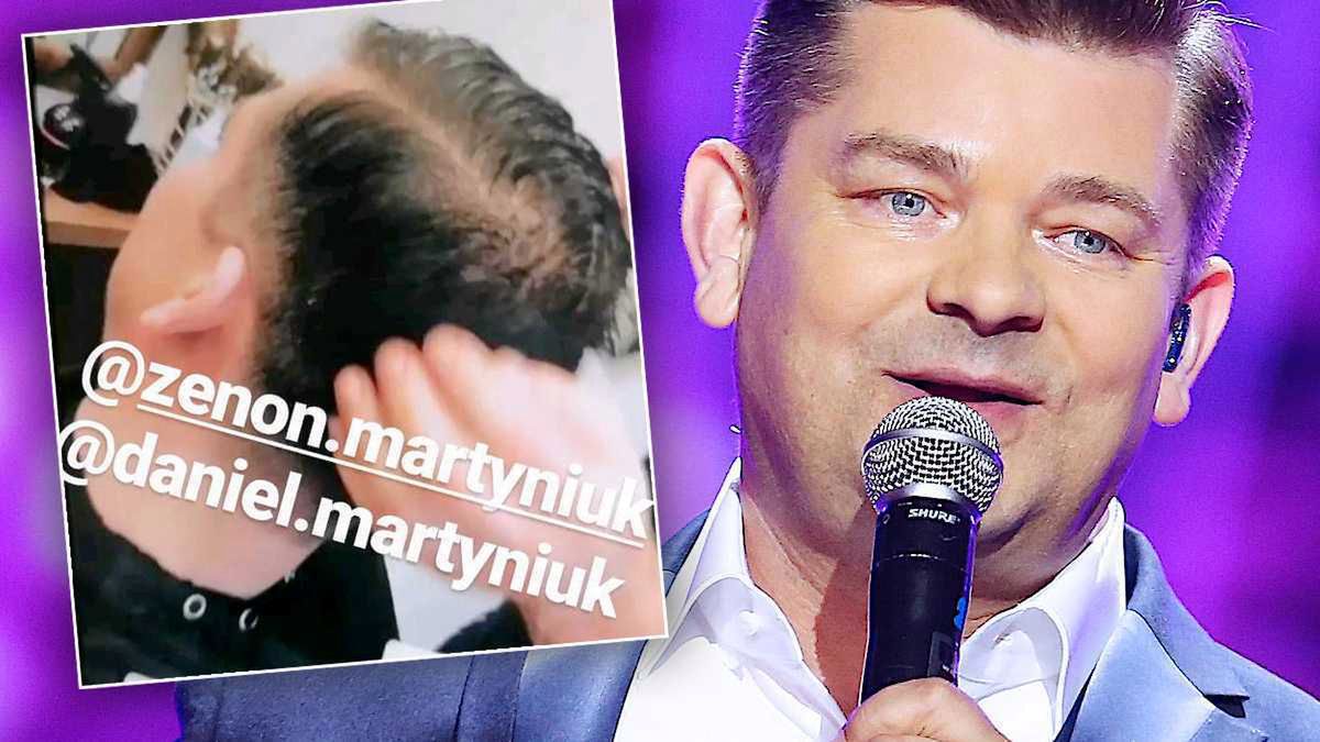 Zenek Martyniuk metamorfoza, fryzura