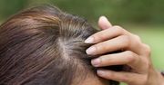 Przyczyny siwienia włosów