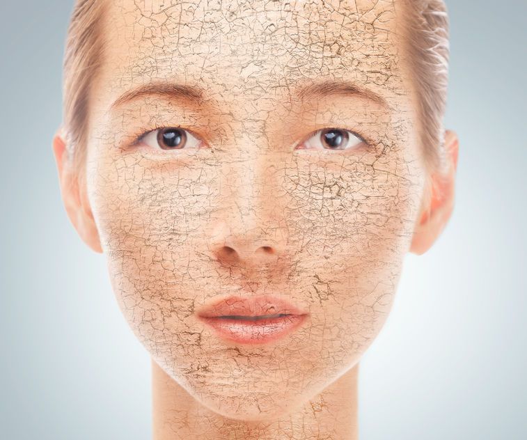 Suche skórki na twarzy i nosie - jak się ich pozbyć?