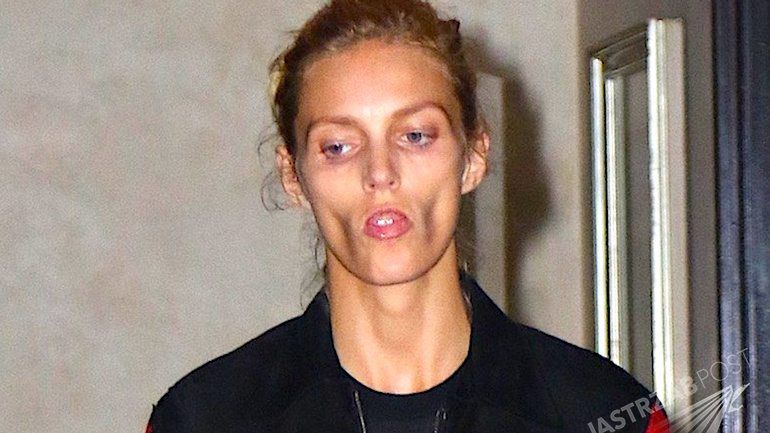 Zapadnięte policzki Anji Rubik (fot. East News)