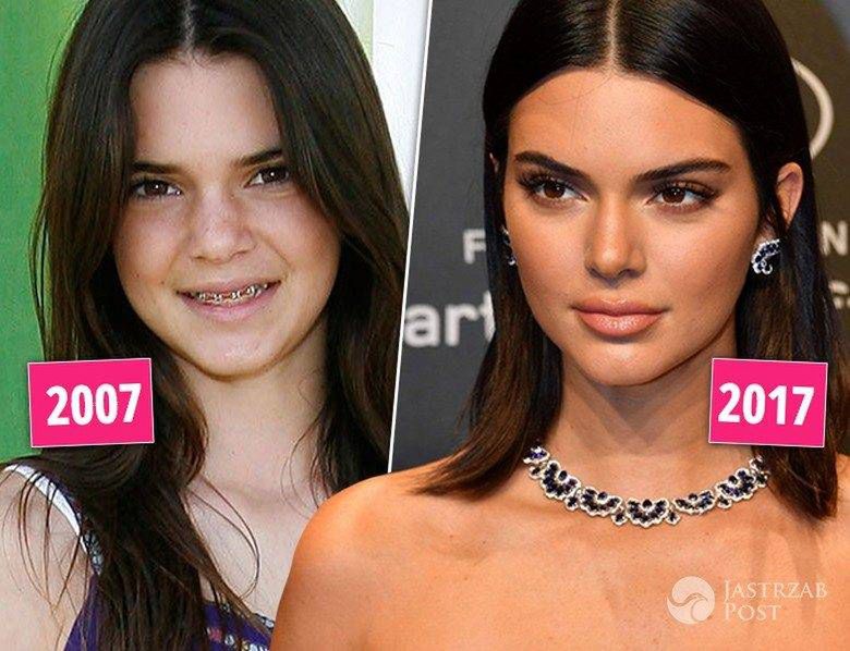 Kendall Jenner - kiedyś i dzisiaj, metamorfoza