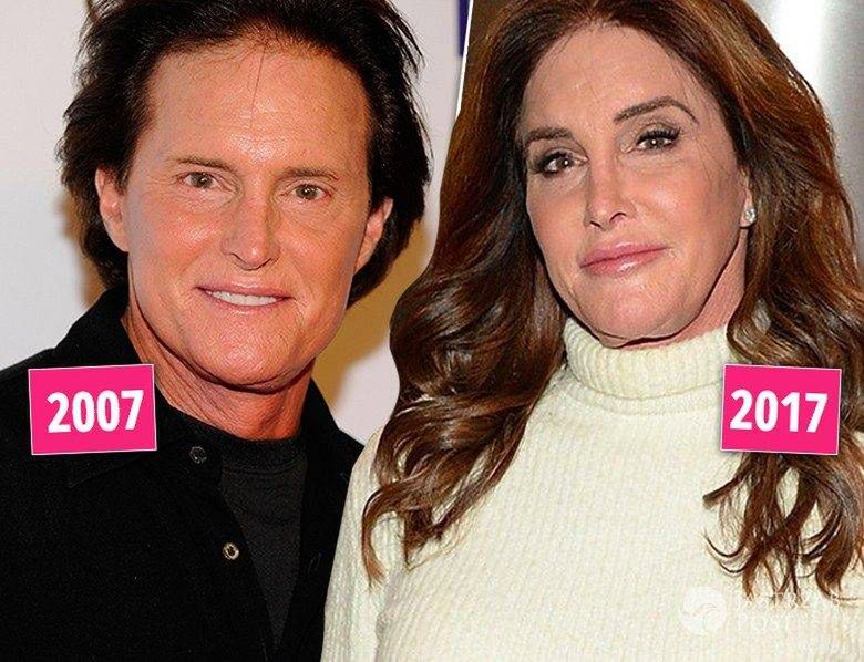 Bruce Jenner/Caitylyn Jenner - kiedyś i dzisiaj, metamorfoza