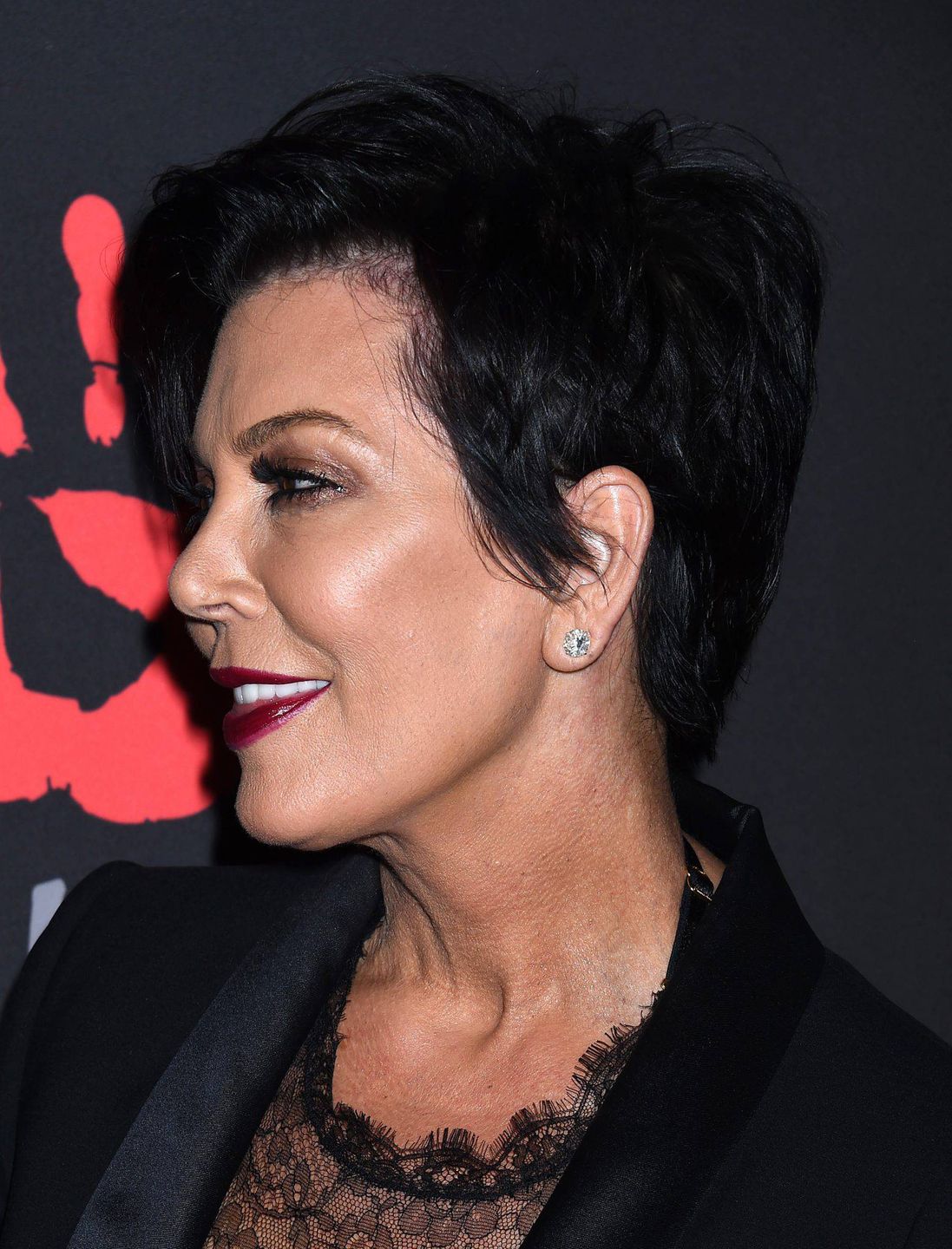 Ucho Kris Jenner przed operacją