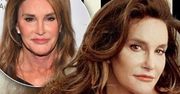 Caitlyn Jenner już nie wygląda tak pięknie! Dopadła ją typowo męska przypadłość