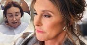 Caitlyn Jenner spędziła święta w samotności. Przeszła poważną operację na którą czekała 25 lat. Wszystko zrelacjonowała w sieci