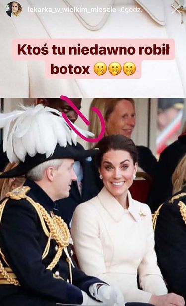 Księżna Kate - komentarz lekarki