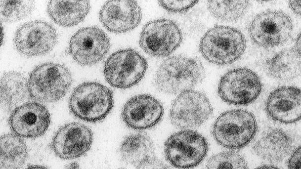 Pigułka przeciwko HIV istnieje i działa 1