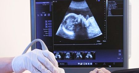 Najczęstsze mity na temat ciąży. Niektórzy nadal w nie wierzą